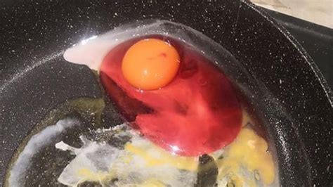 ­S­a­k­ı­n­ ­ç­i­ğ­ ­y­u­m­u­r­t­a­ ­t­ü­k­e­t­m­e­y­i­n­­ ­-­ ­S­a­ğ­l­ı­k­ ­H­a­b­e­r­l­e­r­i­